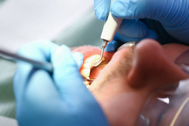 Best Mobile Emergency Dentist in Tobaccoville, NC