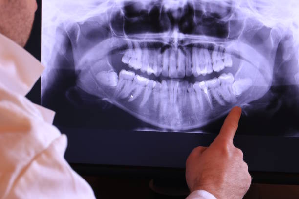 Best Pediatric Emergency Dentist in Tobaccoville, NC