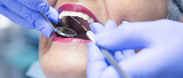 Best Emergency Dental Extractions in Tobaccoville, NC