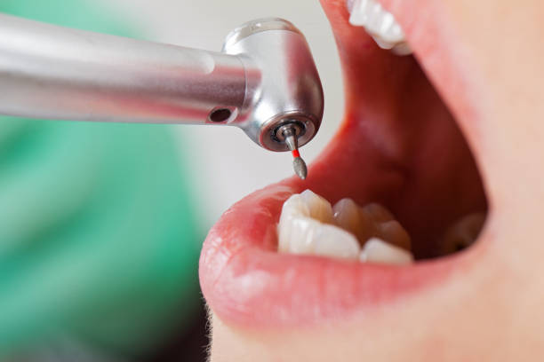 Best Emergency Dentist for Knocked-Out Tooth in Tobaccoville, NC